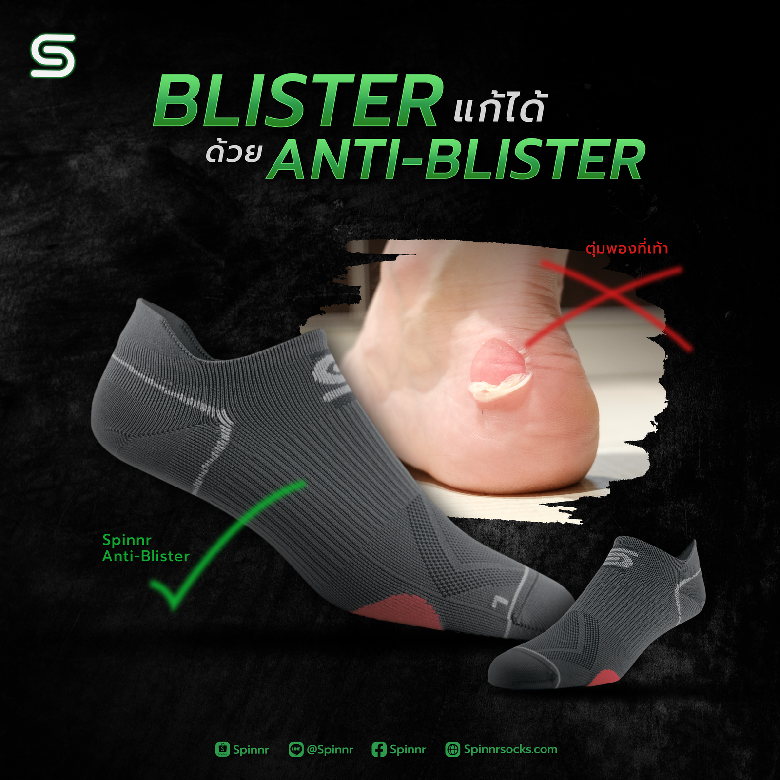 SPINNR # Blister ตุ่มพองที่เท้า ป้องกันได้